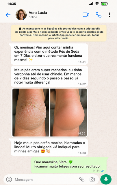 Depoimento 1 - Pés de Seda em 7 Dias
