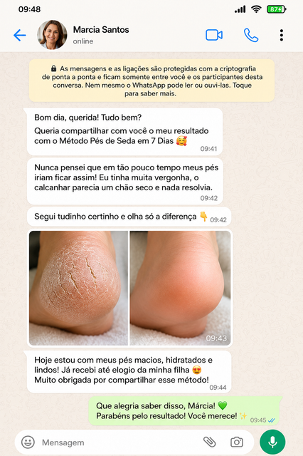 Depoimento 2 - Pés de Seda em 7 Dias